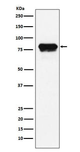 Anti-PLTP Rabbit Monoclonal Antibody Boster Bio
