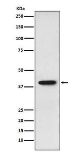 Anti-SET Monoclonal Antibody Boster Bio
