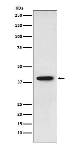 Anti-SET Monoclonal Antibody Boster Bio