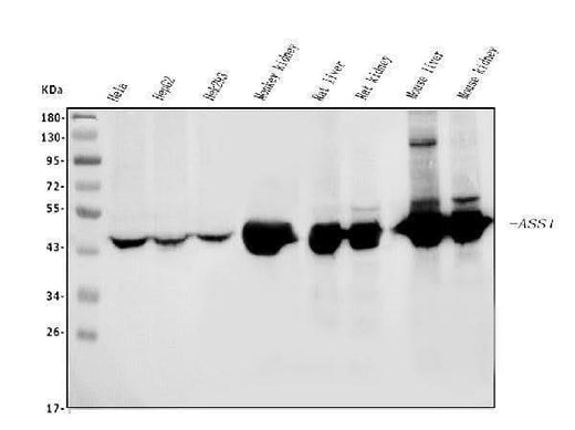 Anti-ASS1 Antibody Picoband® (monoclonal, 5I5 Boster Bio