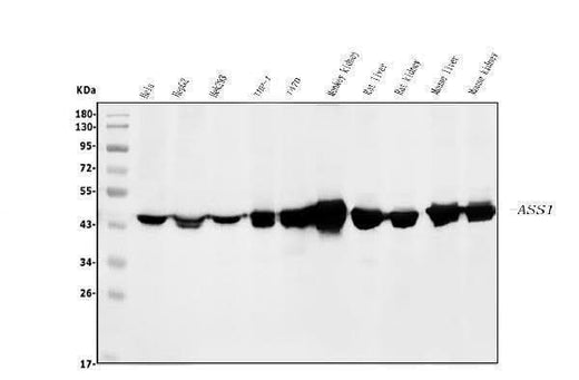 Anti-ASS1 Antibody Picoband® (monoclonal, 7I9 Boster Bio