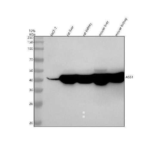 Anti-ASS1 Rabbit Monoclonal Antibody Boster Bio