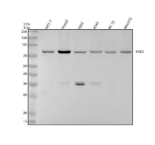 Anti-RSK2 / RPS6KA3 Rabbit Monoclonal Antibody Boster Bio