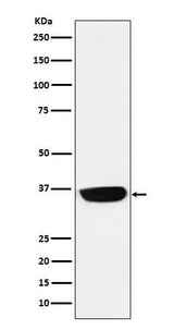 Anti-PHOX2B Monoclonal Antibody Boster Bio