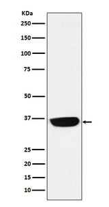 Anti-PHOX2B Monoclonal Antibody Boster Bio