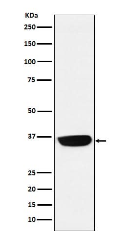 Anti-PHOX2B Monoclonal Antibody Boster Bio