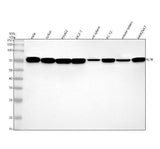 Anti-IL7R alpha/CD127 Rabbit Monoclonal Antibody Boster Bio