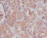 Anti-STK3/Mst2 Rabbit Monoclonal Antibody Boster Bio