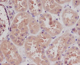 Anti-STK3/Mst2 Rabbit Monoclonal Antibody Boster Bio