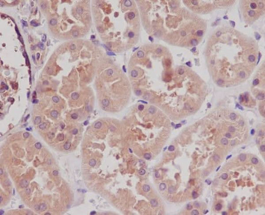 Anti-STK3/Mst2 Rabbit Monoclonal Antibody Boster Bio