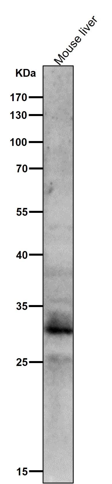 Anti-Phospho-MST1/MST2 (T183 + T180) Rabbit Monoclonal Antibody Boster Bio