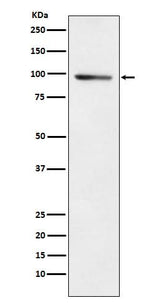 Anti-PDE4B Rabbit Monoclonal Antibody Boster Bio