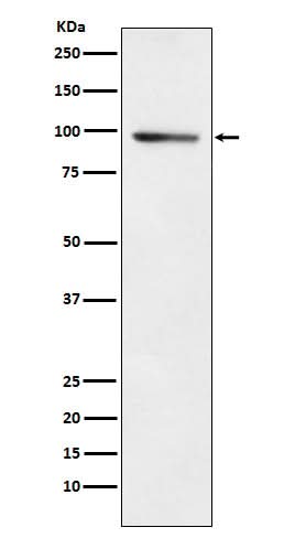 Anti-PDE4B Rabbit Monoclonal Antibody Boster Bio