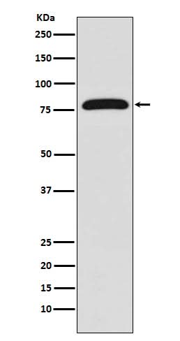 Anti-TGM2/Transglutaminase 2 Rabbit Monoclonal Antibody Boster Bio
