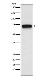 Anti-ACHA4 Rabbit Monoclonal Antibody Boster Bio