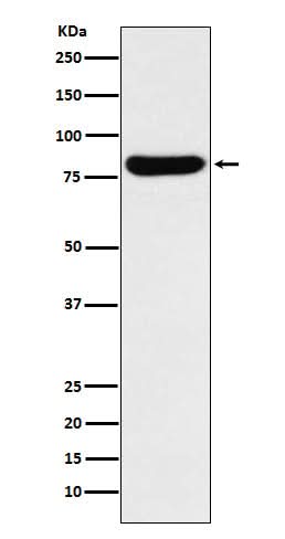 Anti-GUSB Rabbit Monoclonal Antibody Boster Bio