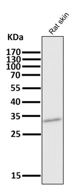 Anti-CD8 CD8A Rabbit Monoclonal Antibody Boster Bio