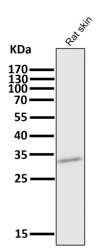 Anti-CD8 CD8A Rabbit Monoclonal Antibody Boster Bio