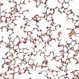 Anti-CD8 alpha Rabbit Monoclonal Antibody Boster Bio
