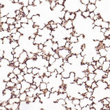 Anti-CD8 alpha Rabbit Monoclonal Antibody Boster Bio