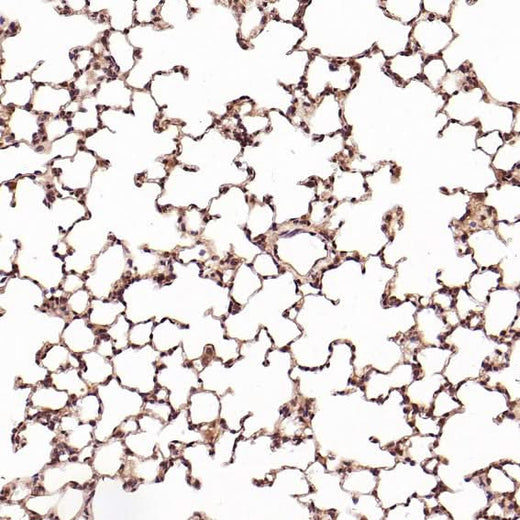 Anti-CD8 alpha Rabbit Monoclonal Antibody Boster Bio
