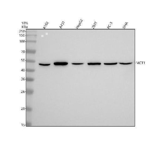 Anti-MCT1 Rabbit Monoclonal Antibody Boster Bio