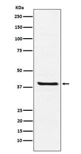 Anti-Arg2 Rabbit Monoclonal Antibody Boster Bio