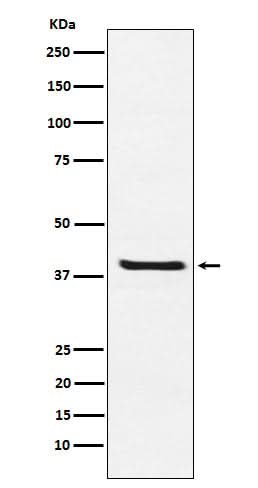 Anti-Arg2 Rabbit Monoclonal Antibody Boster Bio