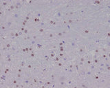 Anti-Olig2 Rabbit Monoclonal Antibody Boster Bio