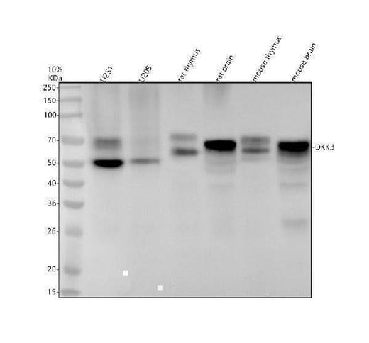 Anti-Dkk3 Rabbit Monoclonal Antibody Boster Bio
