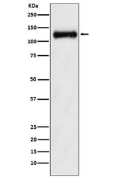 Anti-ANPRB Rabbit Monoclonal Antibody Boster Bio