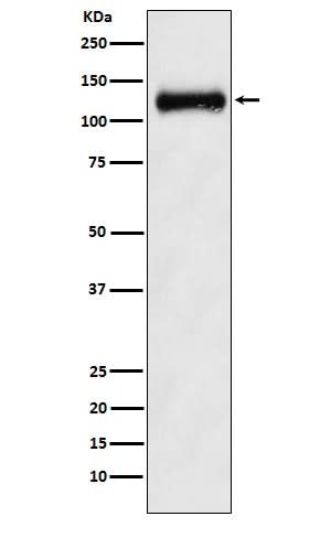 Anti-ANPRB Rabbit Monoclonal Antibody Boster Bio