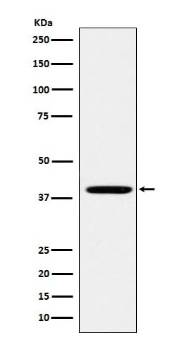 Anti-FOLR1 Rabbit Monoclonal Antibody Boster Bio