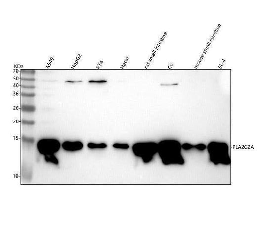 Anti-PLA2G2A Rabbit Monoclonal Antibody Boster Bio