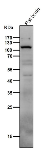 Anti-PI 3 Kinase p110 delta PIK3CD Rabbit Monoclonal Antibody Boster Bio