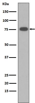 Anti-Vitronectin VTN Rabbit Monoclonal Antibody Boster Bio