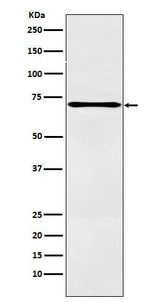 Anti-LOX12 Rabbit Monoclonal Antibody Boster Bio