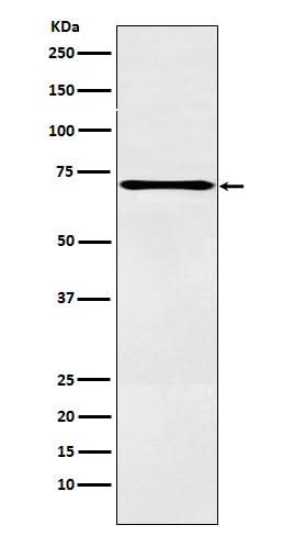 Anti-LOX12 Rabbit Monoclonal Antibody Boster Bio