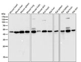 Anti-DUSP1/Mkp 1 Rabbit Monoclonal Antibody Boster Bio