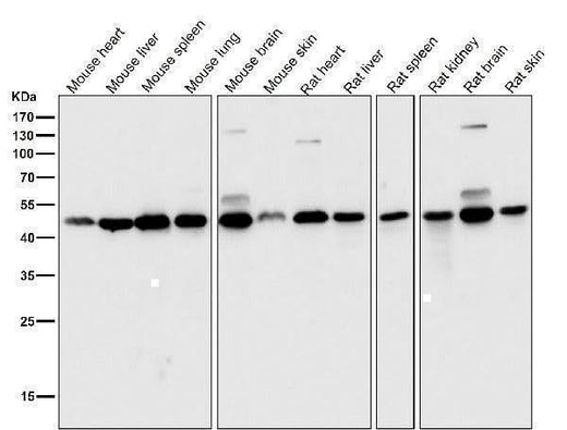 Anti-DUSP1/Mkp 1 Rabbit Monoclonal Antibody Boster Bio