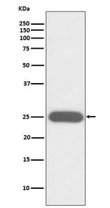 Anti-G-CSF CSF3 Rabbit Monoclonal Antibody Boster Bio