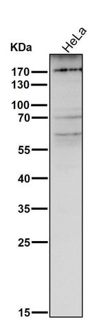 Anti-MRC1/Cd206 Rabbit Monoclonal Antibody Boster Bio
