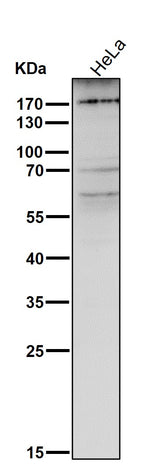 Anti-MRC1/Cd206 Rabbit Monoclonal Antibody Boster Bio
