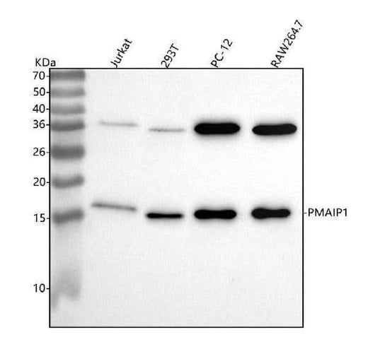 Anti-Noxa Rabbit Monoclonal Antibody Boster Bio
