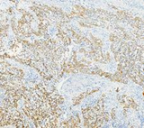 Anti-Cytokeratin 17 Rabbit Monoclonal Antibody Boster Bio