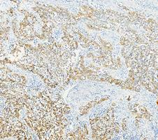 Anti-Cytokeratin 17 Rabbit Monoclonal Antibody Boster Bio