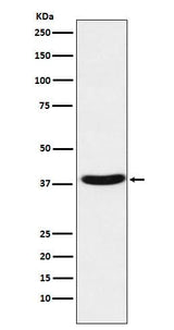 Anti-MT-ND1 Rabbit Monoclonal Antibody Boster Bio