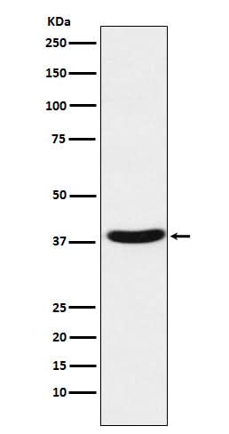 Anti-MT-ND1 Rabbit Monoclonal Antibody Boster Bio