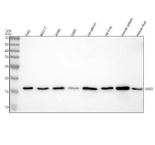 Anti-UBE2I/Ubc9 Rabbit Monoclonal Antibody Boster Bio