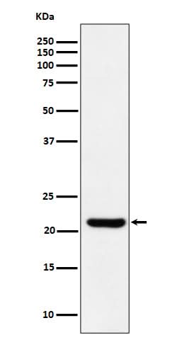 Anti-ITPA Rabbit Monoclonal Antibody Boster Bio
